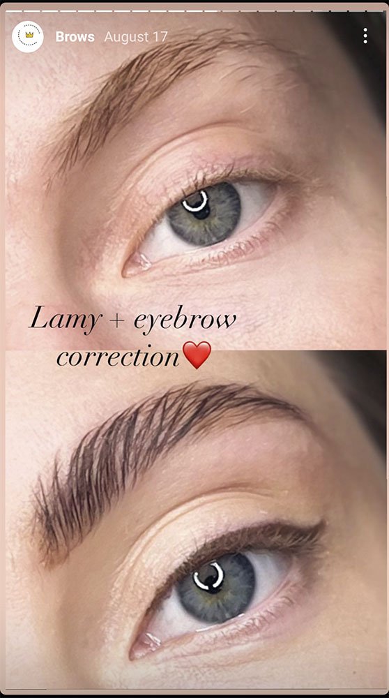 Brows correction Amsterdam